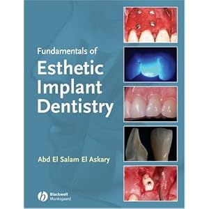 Click here to buy Fundamentals of Esthetic Dentistry, Second Edition by Abd El Salam El Askary.