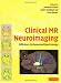 Clinical MR Neuroimaging: Diffusion, Perfusion and Spectroscopy