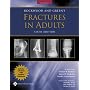 Rockwood and Green's Fractures in Adults: Rockwood, Green, and Wilkins' Fractures, 2 Volume Set