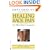 Healing Back Pain