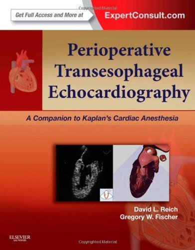 Perioperative Transesophageal Echocardiography: A Companion to Kaplan's Cardiac Anesthesia (Expert Consult: Online and Print), 1e Perioperative Transesophageal Echocardiography: A Companion to Kaplan's Cardiac Anesthesia (Expert Consult: Online and Print), 1e