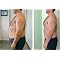 Best Carb Blocker weight loss pills
