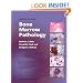 Bone Marrow Pathology