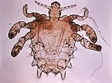Pubic Lice Crabs