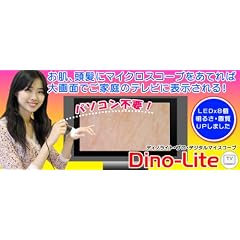 サンコ- DinoLite Pro DigitalMicroscopeTV DILITTV2