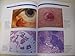 Atlas of Mohs Surgery Frozen Sections, Updated Edition