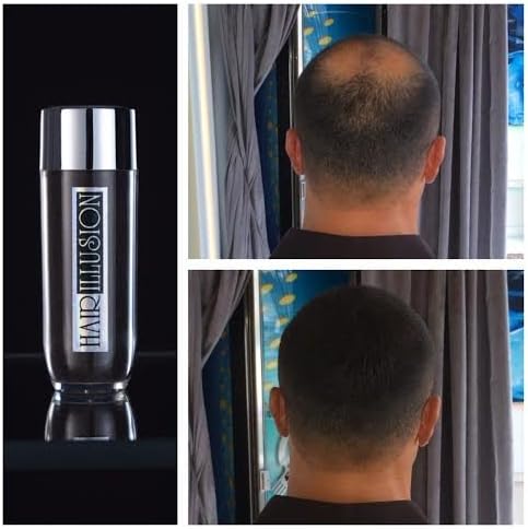 Hair Illusion Premium Hair Loss Concealer for Men & Women, Latest Generation Hair Building Formulation with 100% Real Human Hair Fibers 26.5g