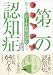 第二の認知症: 増えるレビー小体型認知症の今