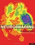 Neuroimaging in epilepsy