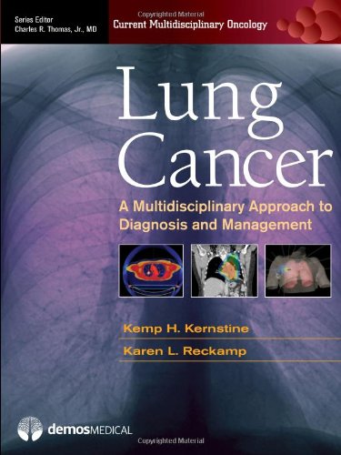 Lung Cancer: A Multidisciplinary Approach to Diagnosis and Management (Current Multidisciplinary Oncology)