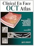 Clinical En Face OCT Atlas