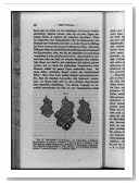 Historic Print (L): [Normal liver cells, abnormal liver cells that have increased in size, and abnormal live