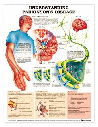 Amazon.com: Understanding Parkinson's Disease Anatomical Chart Paper ...