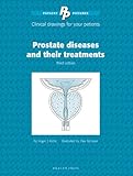 Prostate diseases and their treatments