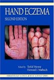 Hand Eczema, Second Edition (Dermatology: Clinical & Basic Science)