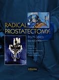 Radical Prostatectomy: From Open to Robotic