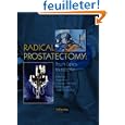 urethral sounds Radical Prostatectomy: urethral sounds Radical Prostatectomy: