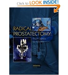 Radical Prostatectomy: From Open to Robotic