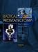 Radical Prostatectomy: From Open to Robotic