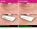 Venin Royale - Snake Venom Anti-Aging and Anti-Wrinkle Peptide Serum for Fine Lines, Rosacea, Uneven Tone | Best Skin Care for Face, Hands & Neck | Neuropeptide Treatment & Botox Cream