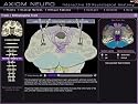 Axiom Neuro