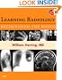 Learning Radiology: Recognizing the Basics (With STUDENT CONSULT Online Access), 1e