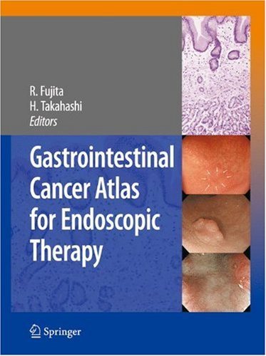Gastrointestinal Cancer Atlas for Endoscopic Therapy