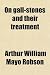gallstones8  - On gallstones and their treatment
