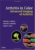 Arthritis in Color: Advanced Imaging of Arthritis Image of Arthritis in Color: Advanced Imaging of Arthritis