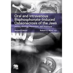 Oral and Intravenous Bisphosphonate Induced Osteonecrosis of the Jaws: History, Etiology,... by Robert E. Marx