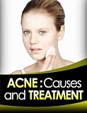 Acne: Causes and Treatment