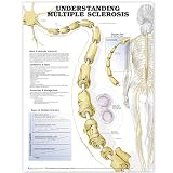 Understanding Multiple Sclerosis Anatomical Chart