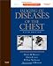 Imaging of Diseases of the Chest: Expert Consult - Online and Print