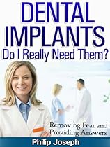 Dental Implants: Do I Really Need Them? (Removing Fear and Providing Questions)