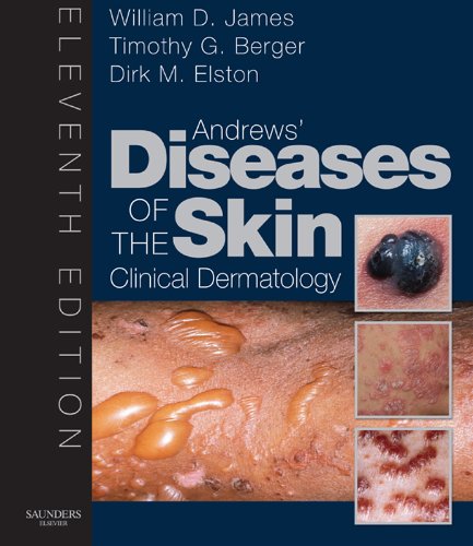 Andrew's Diseases of the Skin: Clinical Dermatology (James, Andrew's Disease of the Skin)