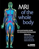 MRI of the whole body : an illustrated guide to common pathologies