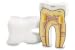 Learning Resources - Cross-Section Tooth Model
