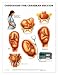 Conditions For Cesarean Section Anatomical Chart Unmounted-9985PU