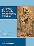 Deep vein thrombosis and pulmonary embolism