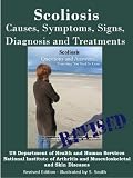 SCOLIOSIS: REVISED EDITION -CAUSES, SYMPTOMS, SIGNS, DIAGNOSIS AND TREATMENTS