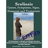SCOLIOSIS: REVISED EDITION -CAUSES, SYMPTOMS, SIGNS, DIAGNOSIS AND TREATMENTS