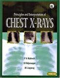 Principles and Interpretation of Chest X-rays