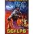 Scalps