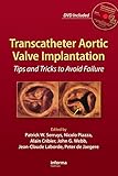 Transcatheter aortic valve implantation : tips and tricks to avoid failure