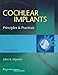 Cochlear Implants: Principles & Practice
