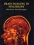 Brain Imaging in Psychiatry (ATAG)