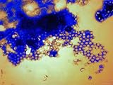 Rotavirus from Stool Diarrhea Virus Intestinal Photographic Poster Print, 16x12