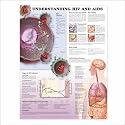 Understanding HIV and AIDS Anatomical Chart