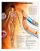 Deep Vein Thrombosis Anatomical Chart Laminated-8953PL1.5