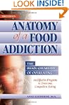 Anatomy of a Food Addiction: The Brai...